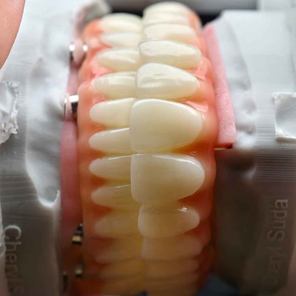 PMMA Bridge With Ti-Base Screw Retained Trying For Full Arch Restoration