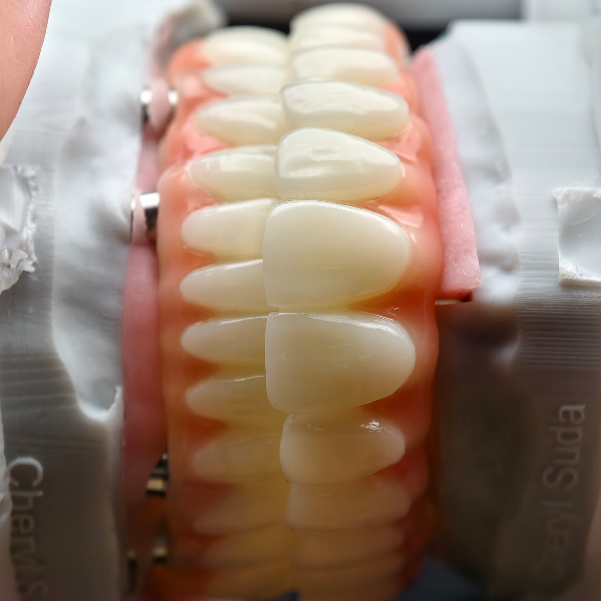 PMMA Bridge With Ti-Base Screw Retained Trying For Full Arch Restoration