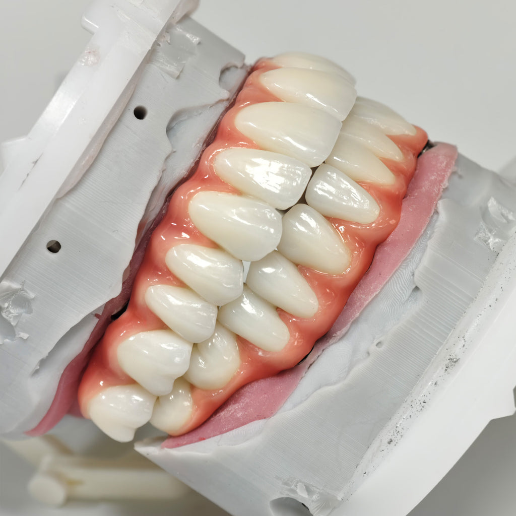 Zirconia-Enamel Hybrid Malo Bridge
