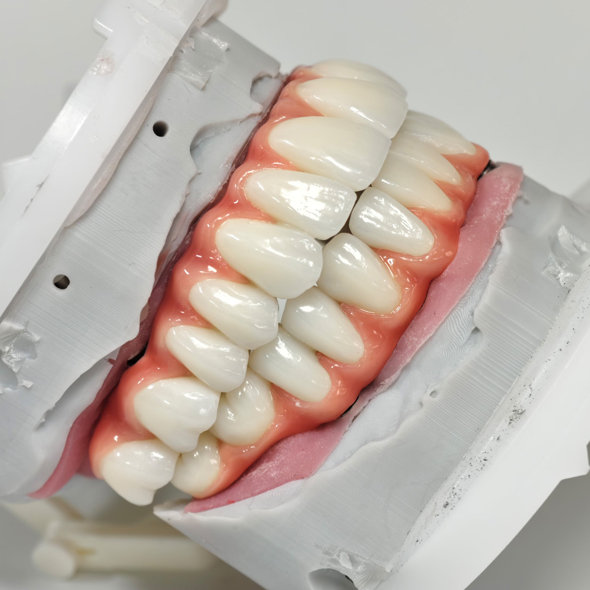 Zirconia-Enamel Hybrid Malo Bridge