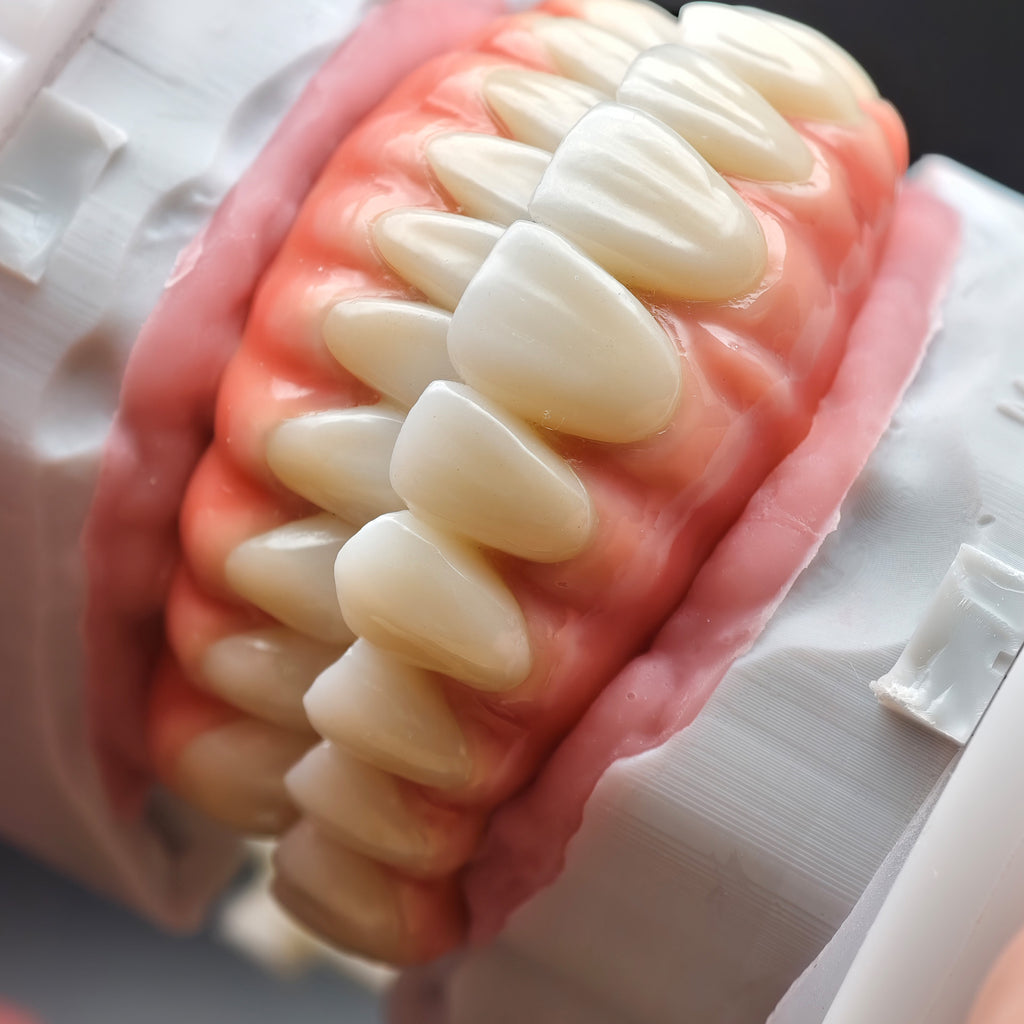 Enhanced Zirconia Crown Malo Bridge