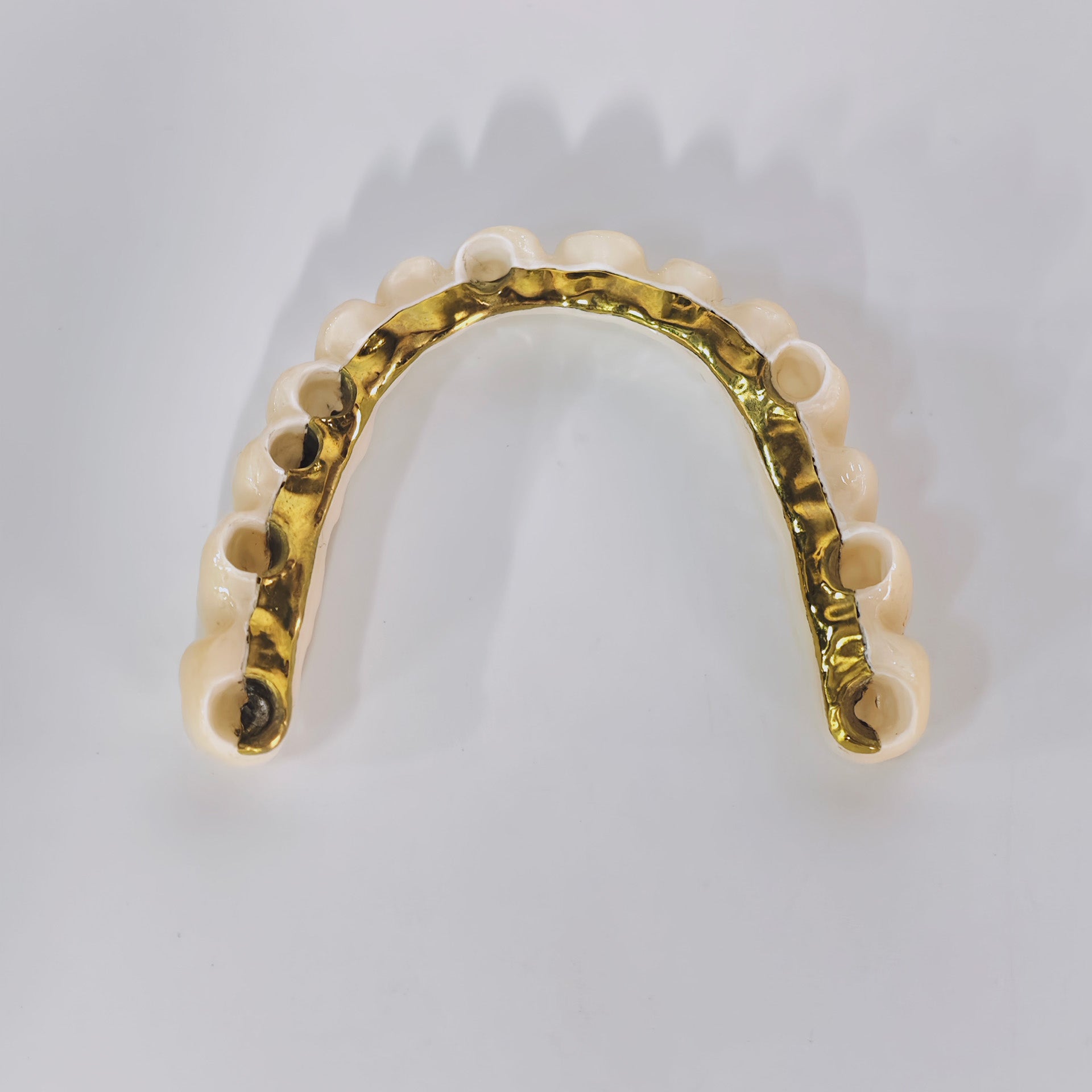 Ti-Bar Titanium Nitride Metal Frame With Zirconia Bridge And Cement Retained