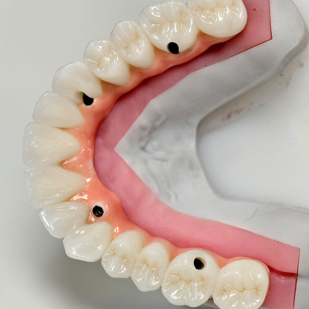Zirconia-Enamel Hybrid Malo Bridge