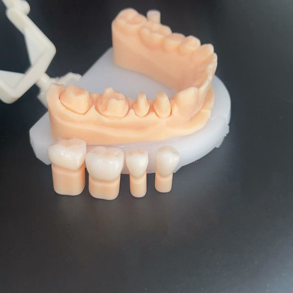 Individual Zirconia Crowns