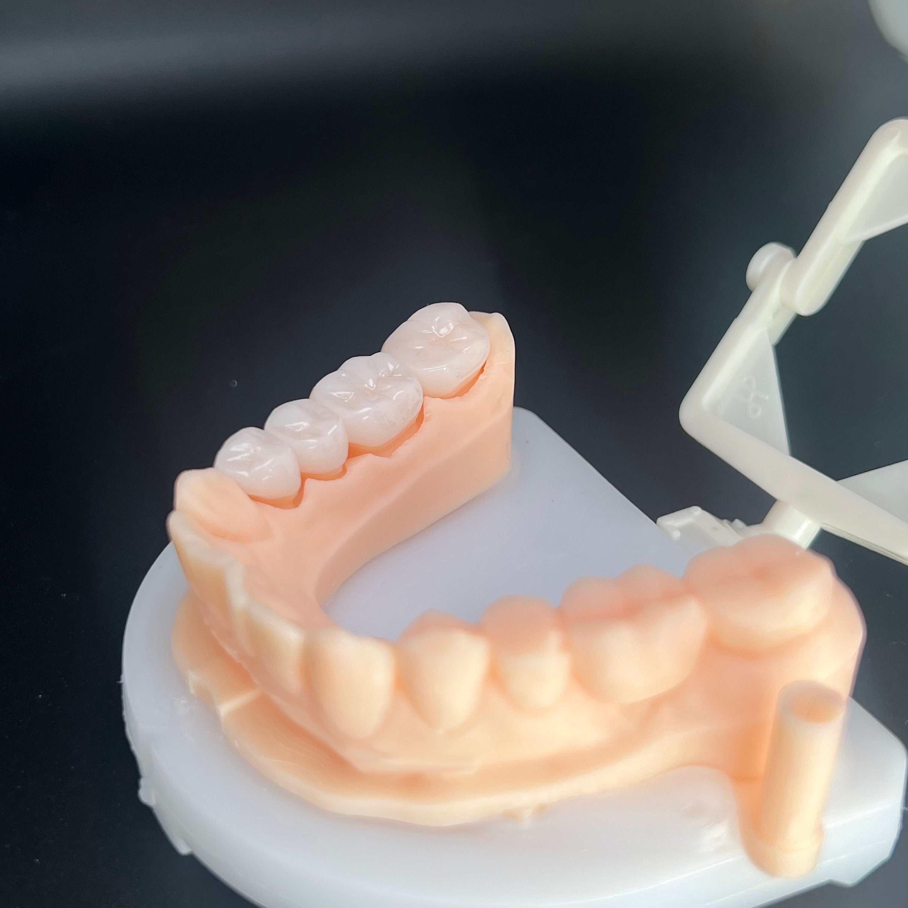 Individual Zirconia Crowns