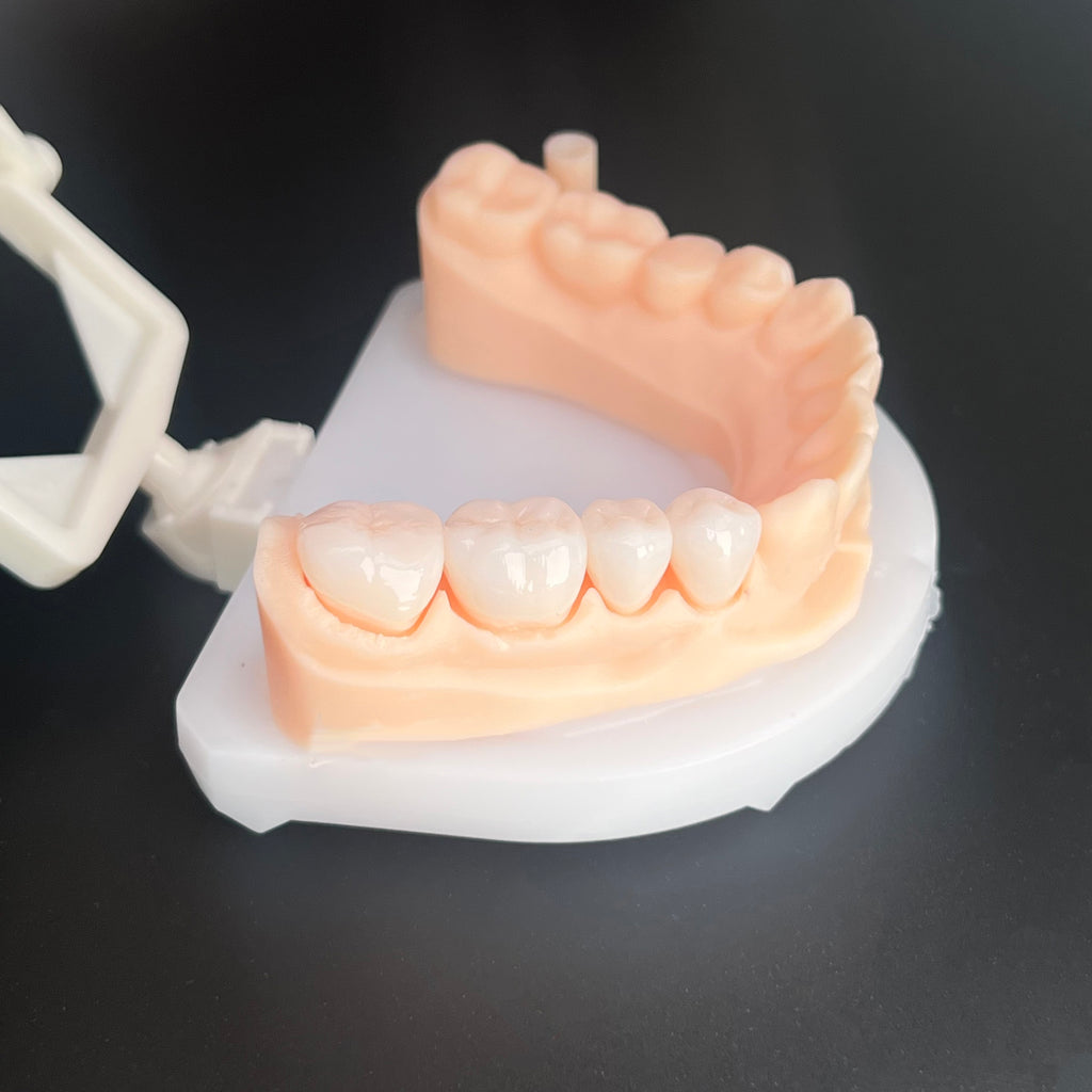 Individual Zirconia Crowns