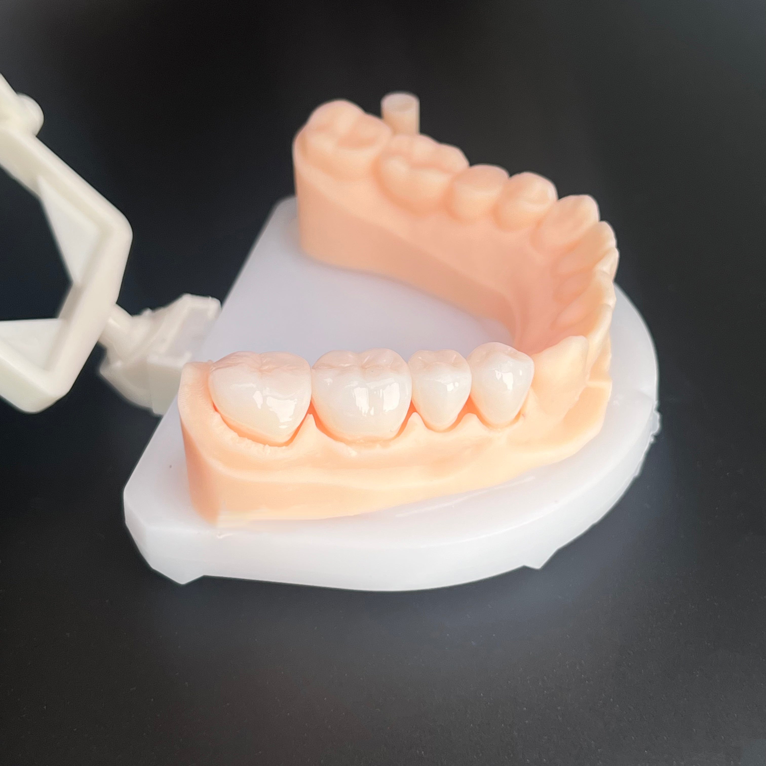 Individual Zirconia Crowns