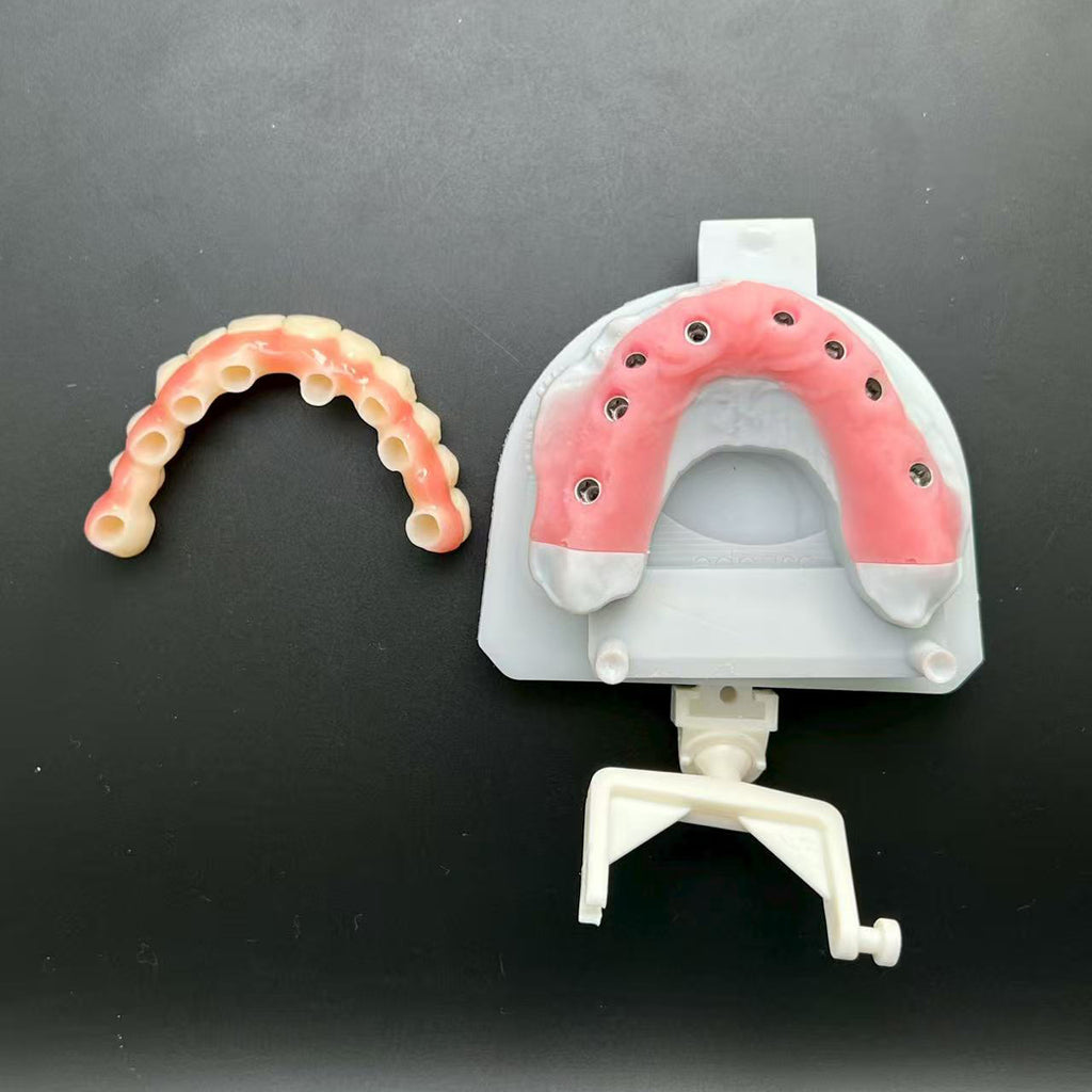 PMMA Bridge With Custom Abutment Cement Retained