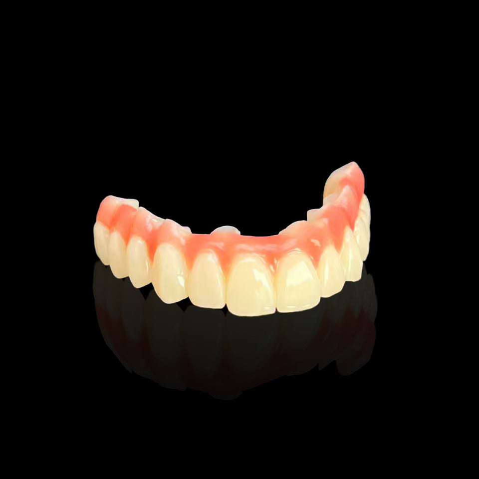 PMMA Bridge With Custom Abutment Cement Retained