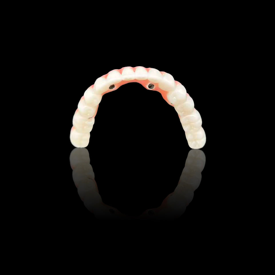 Zirconia Crown - Enhanced Malo Bridge