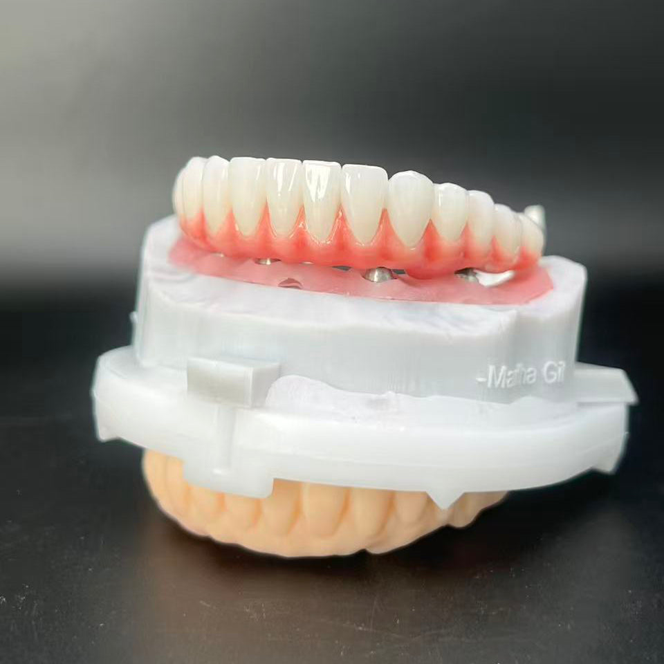 Zirconia Crown - Enhanced Malo Bridge