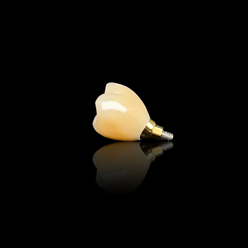 Precision Zirconia Implant Crown