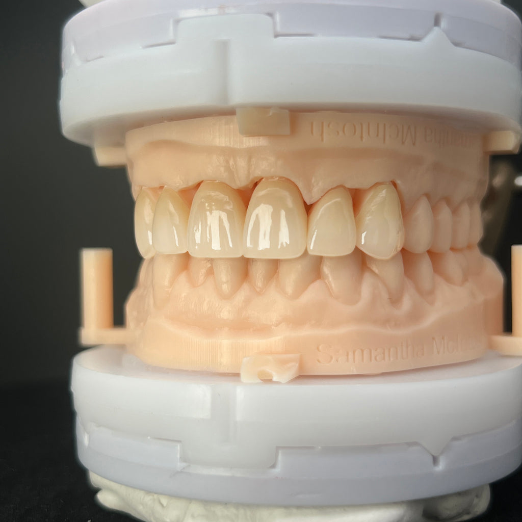 Multilayer Zirconia Dental Restorations