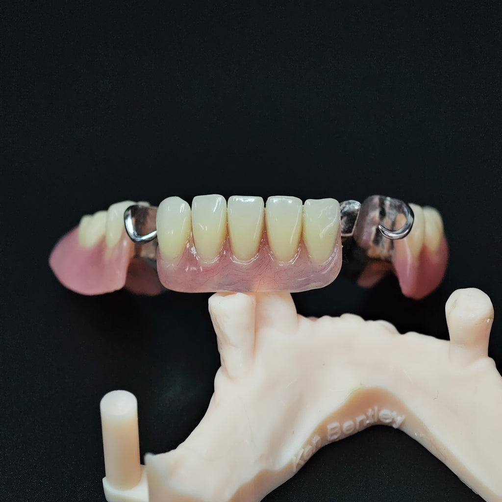 Cobalt Chrome Framework Denture Metal Framework With Acrylic Denture