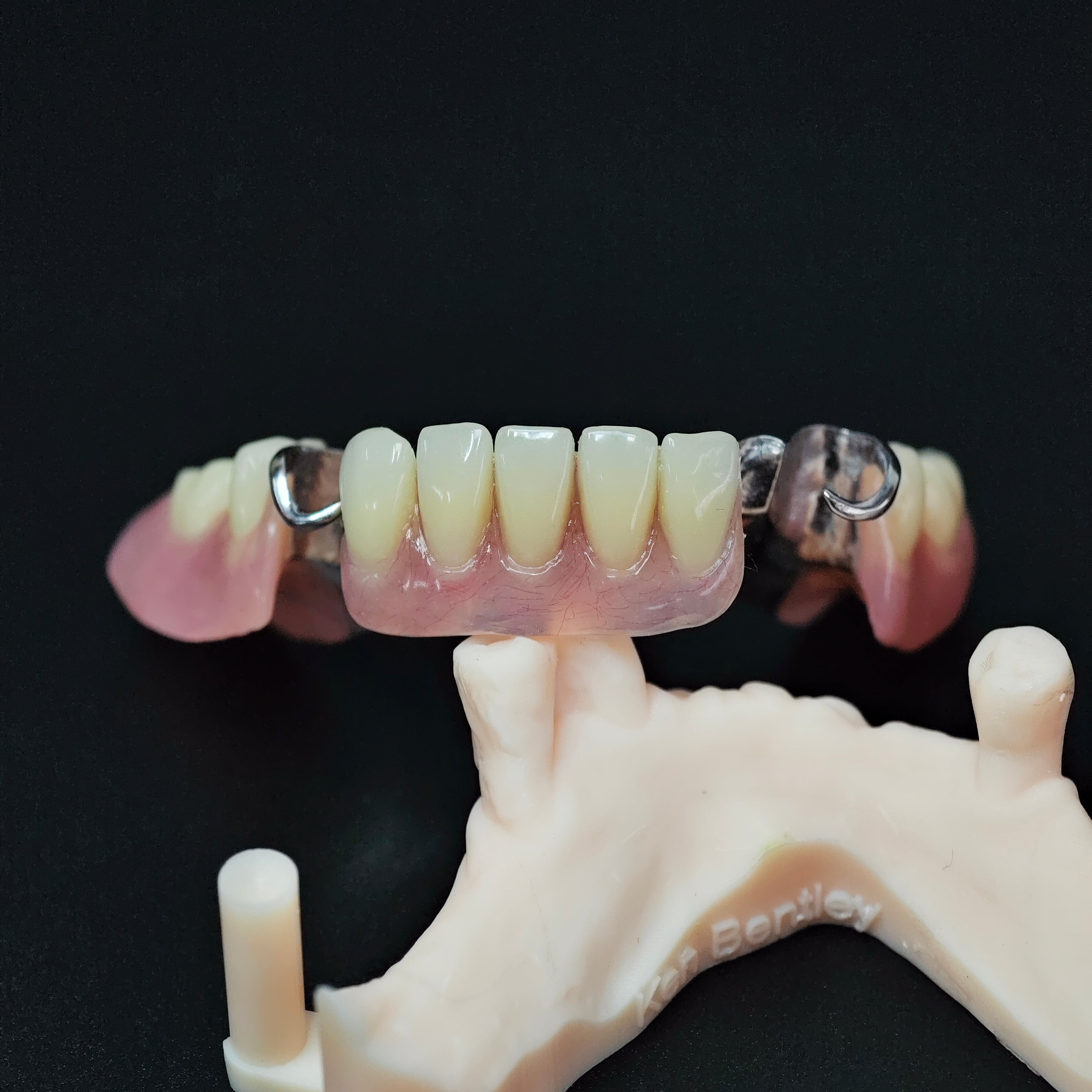 Cobalt Chrome Framework Denture Metal Framework With Acrylic Denture