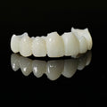 Full Arch Restoration For Temp Bridge Pmma Bridge
