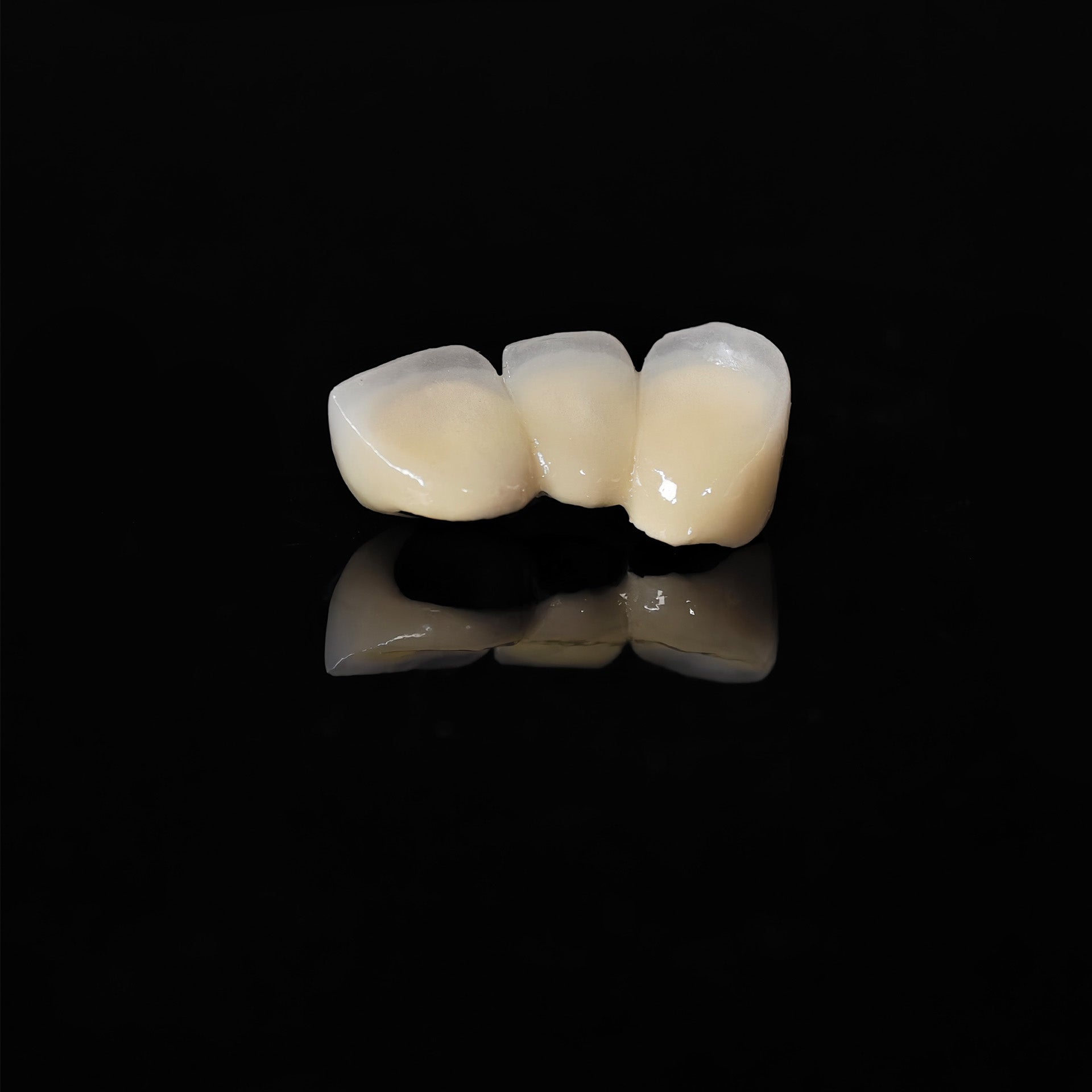 Co - Cr PFM Dental Bridge With Metal Post-And-Core