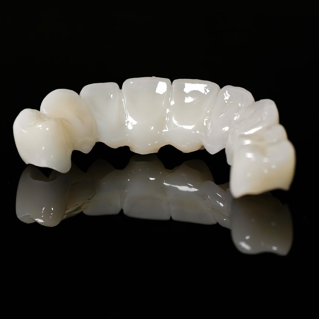 Full Arch Restoration For Temp Bridge Pmma Bridge