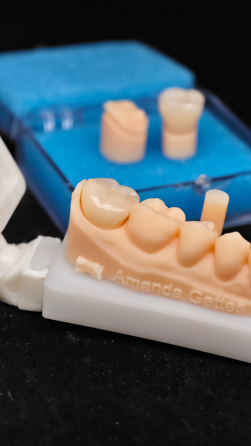 High - Strength Zirconia Dental Crowns