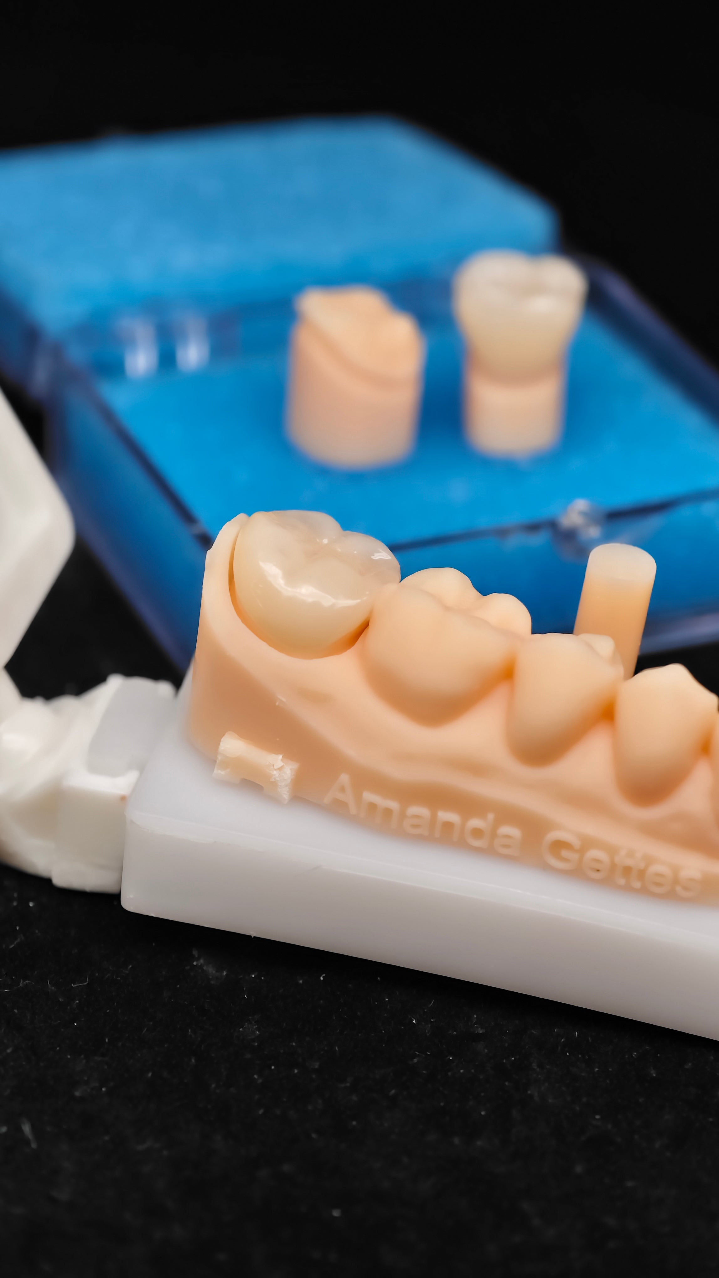 High - Strength Zirconia Dental Crowns