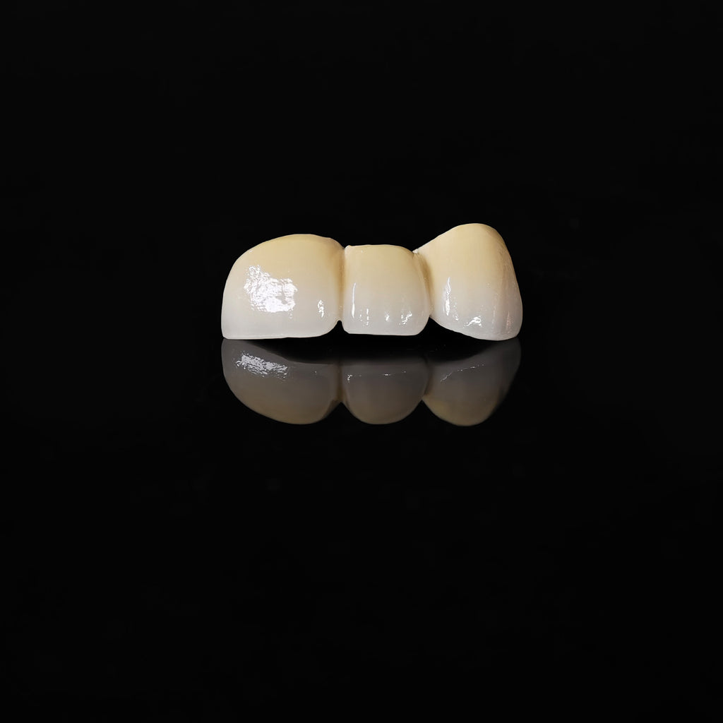 Co - Cr PFM Dental Bridge With Metal Post-And-Core