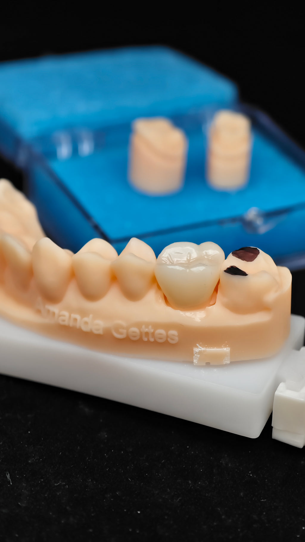 High - Strength Zirconia Dental Crowns