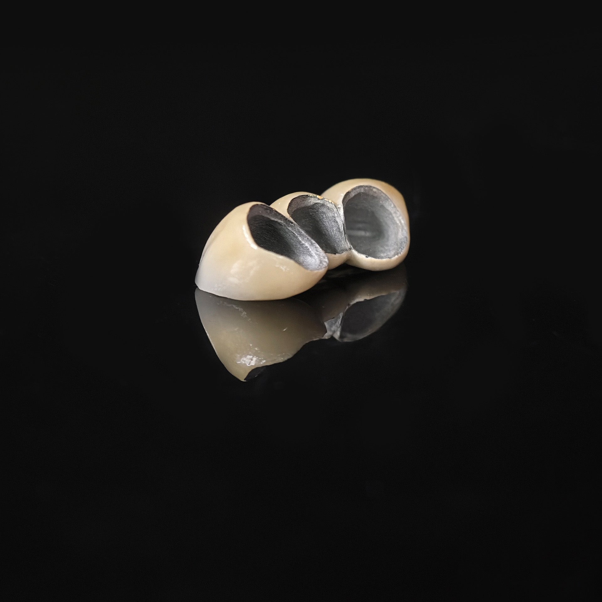 Co - Cr PFM Dental Bridge With Metal Post-And-Core