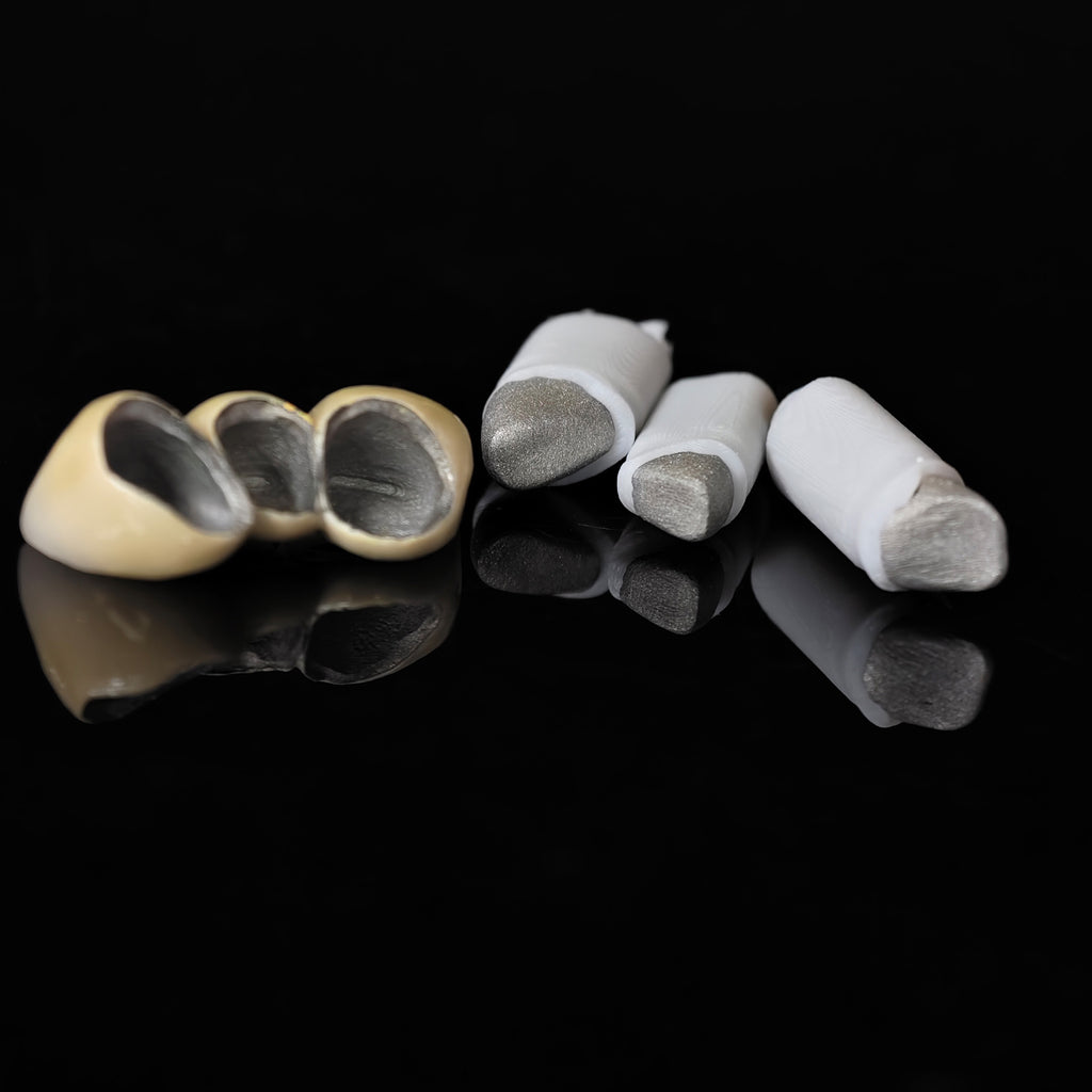 Co - Cr PFM Dental Bridge With Metal Post-And-Core