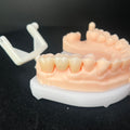 Premium Zirconia Dental Implant Abutment