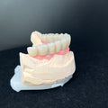 Full Arch Restoration For Temp Bridge Pmma Bridge