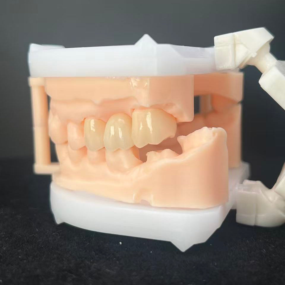 Premium Zirconia Dental Implant Abutment