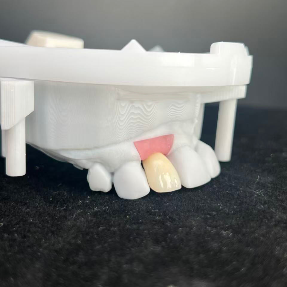 Zirconia Implant Crown With Enhanced Biocompatibility