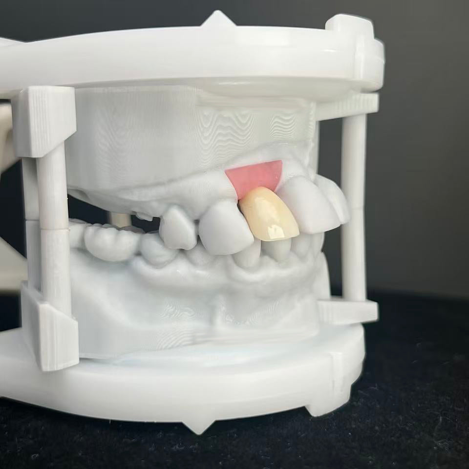 Zirconia Implant Crown With Enhanced Biocompatibility