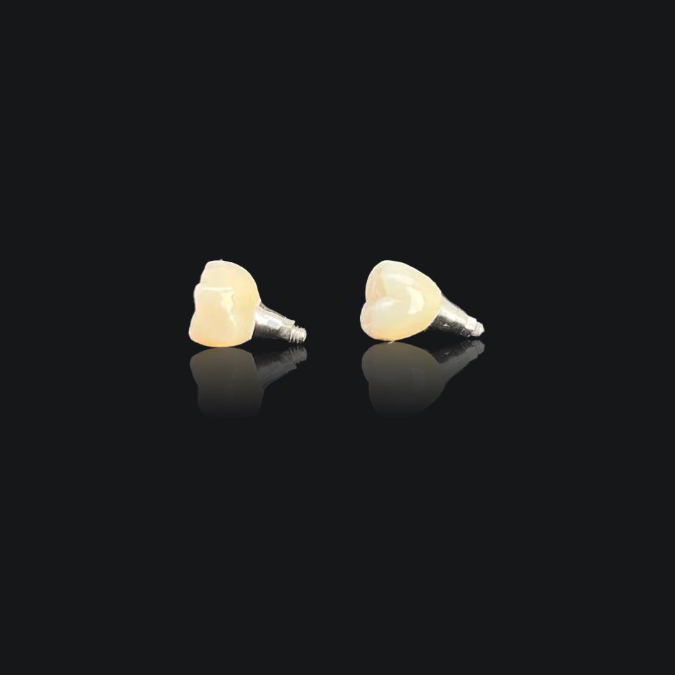 Ultra - Thin Zirconia Implant Bridge
