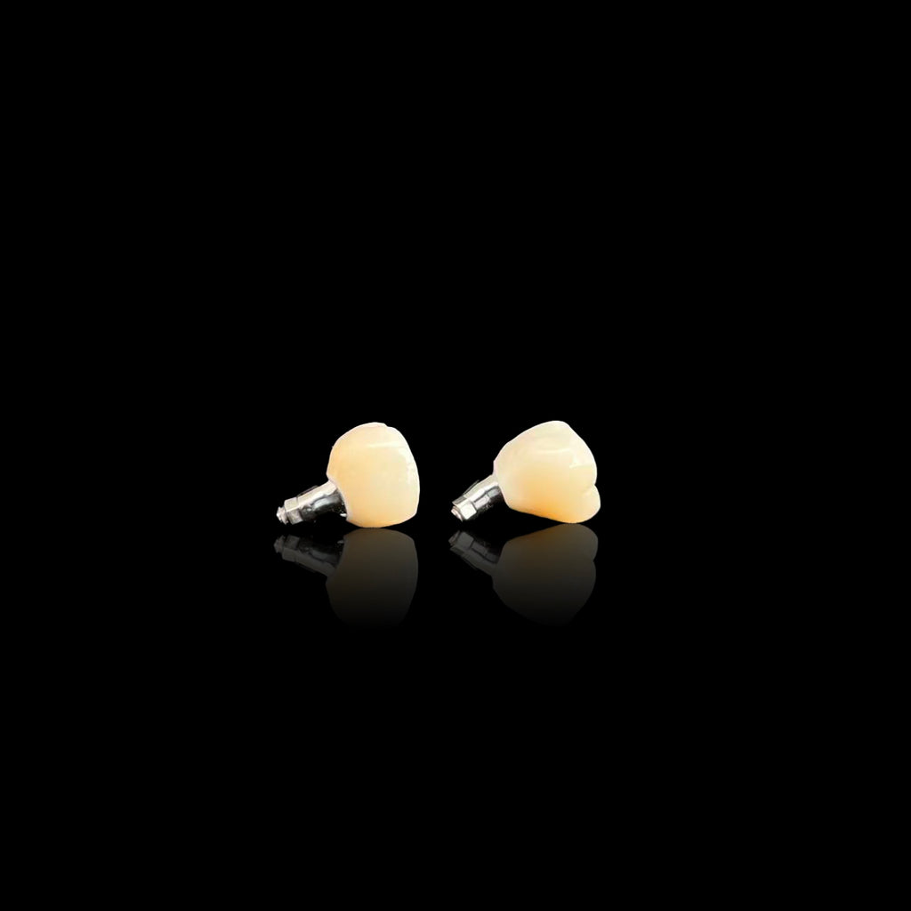Ultra - Thin Zirconia Implant Bridge