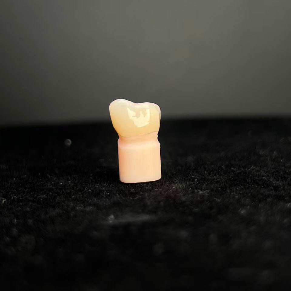 Natural - Looking Zirconia Crowns