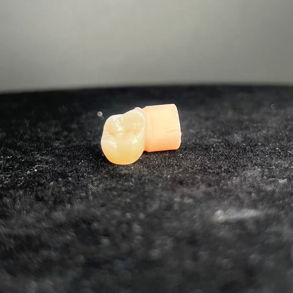 Natural - Looking Zirconia Crowns