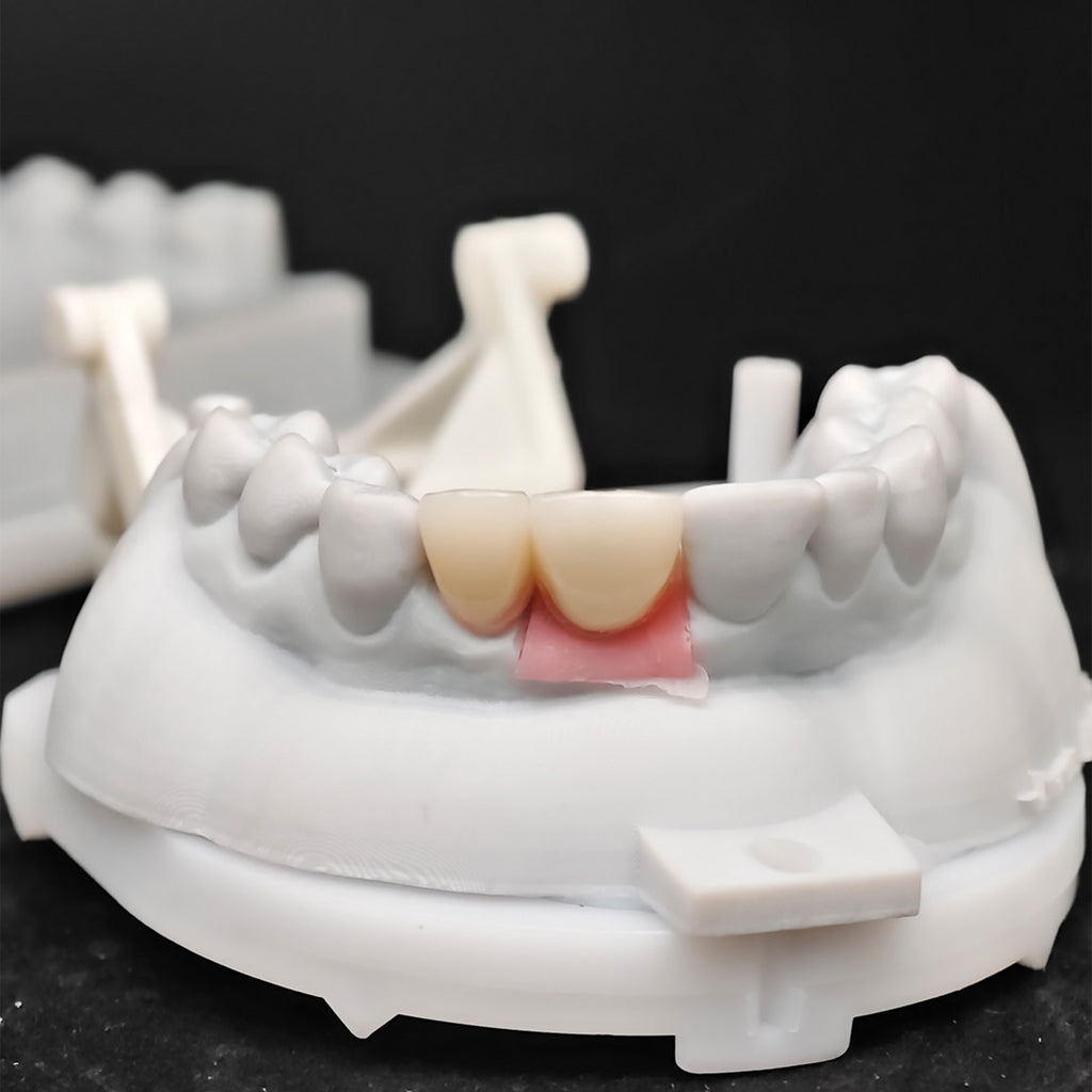 Ustom Zirconia Implant Crowns