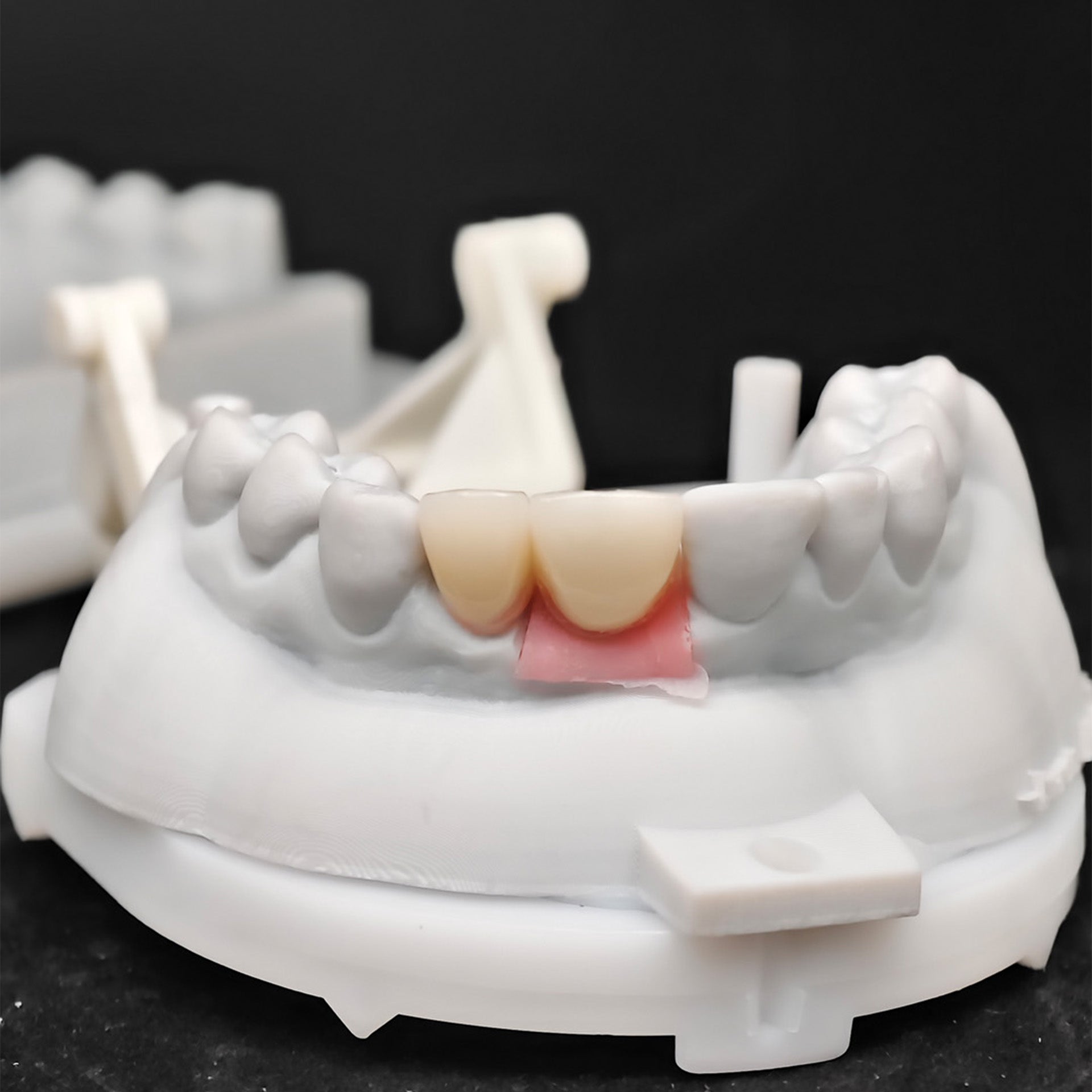 Ustom Zirconia Implant Crowns