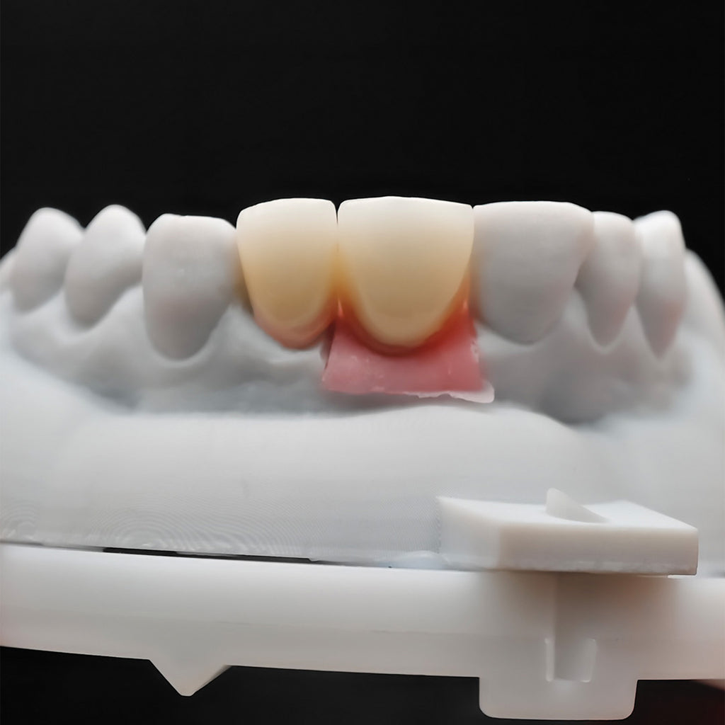 Ustom Zirconia Implant Crowns
