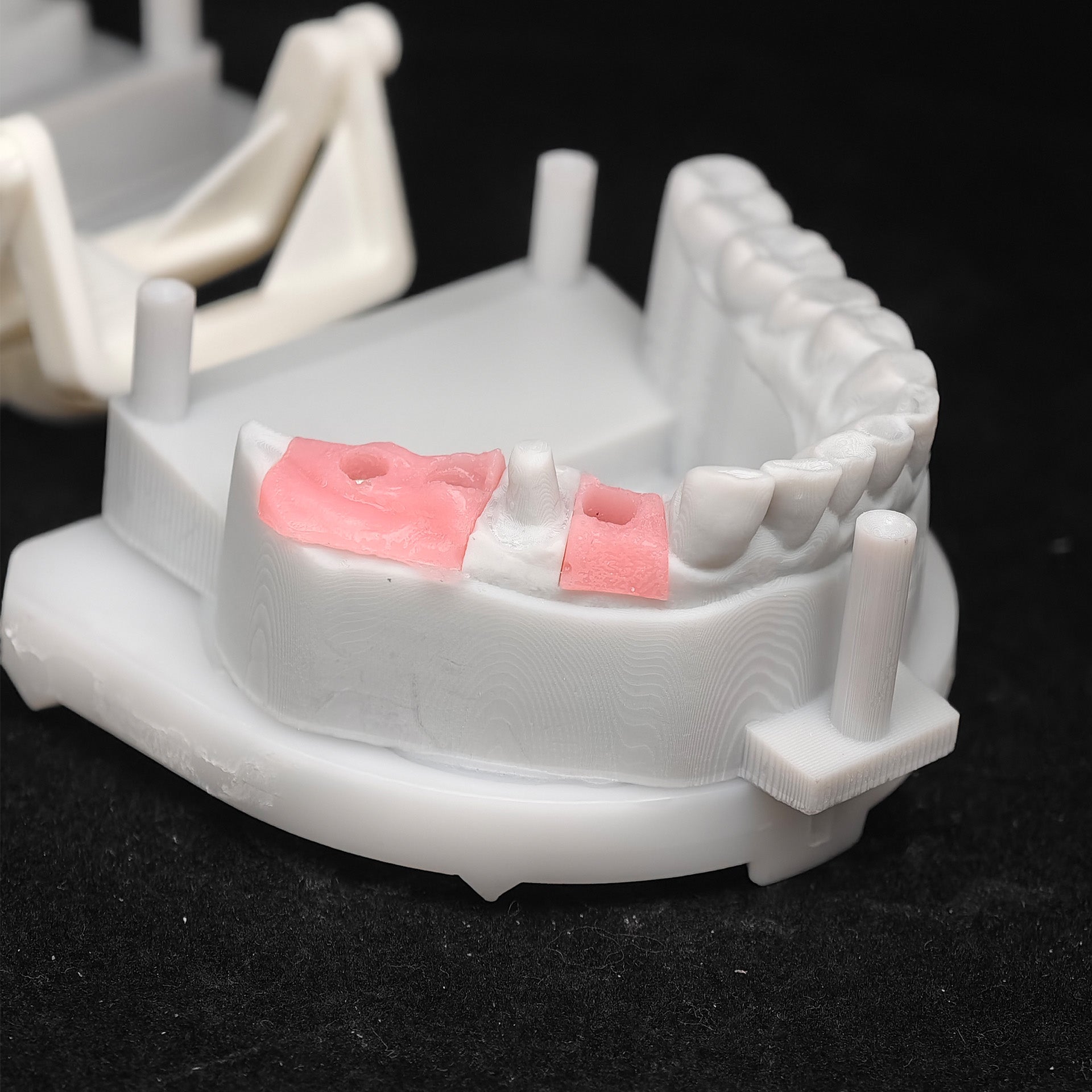 Custom Zirconia Implant Crown And Bridge