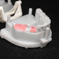 Custom Zirconia Implant Crown And Bridge