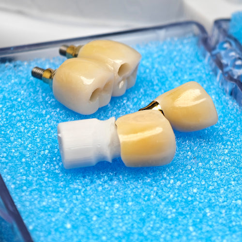 Custom Zirconia Implant Crown And Bridge