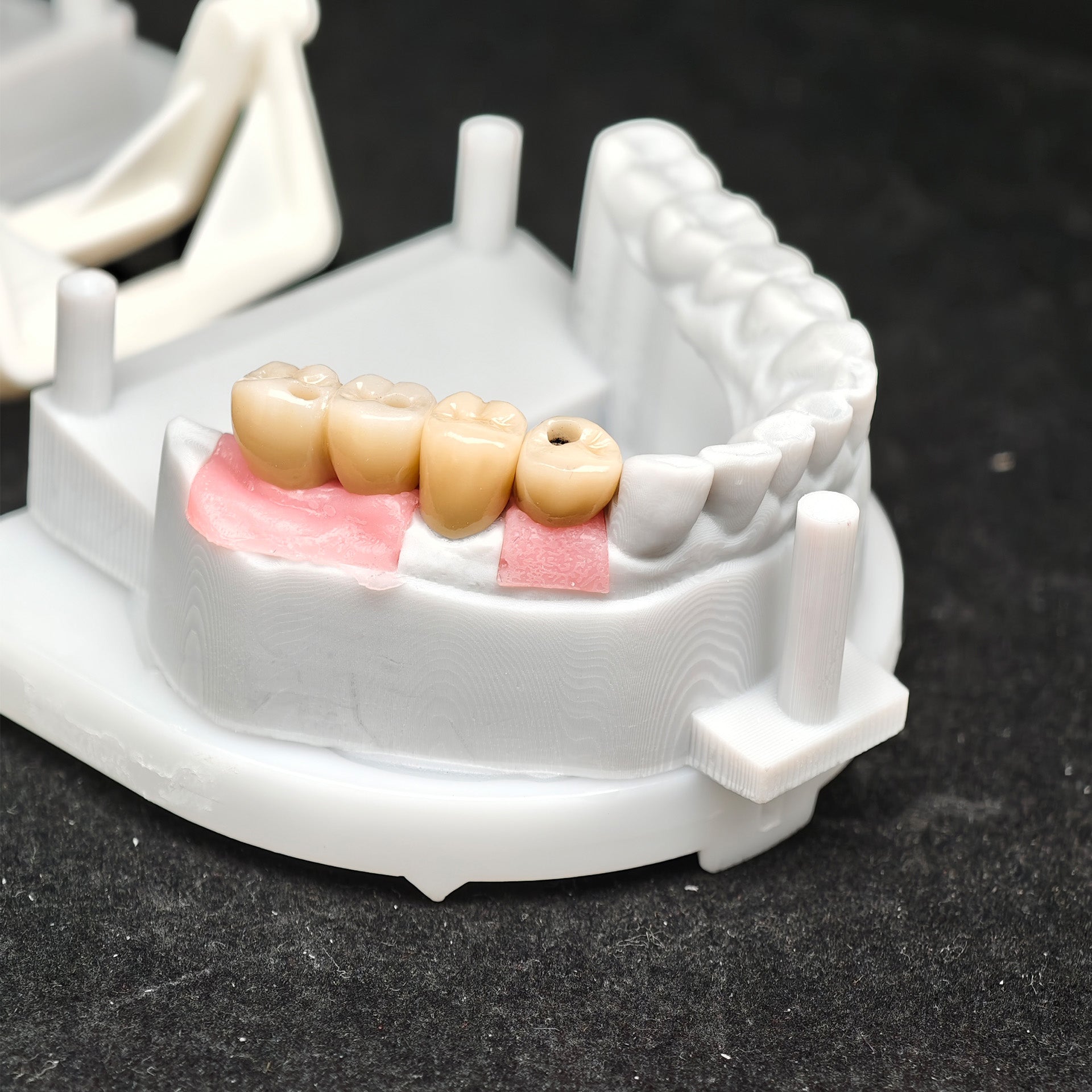 Custom Zirconia Implant Crown And Bridge