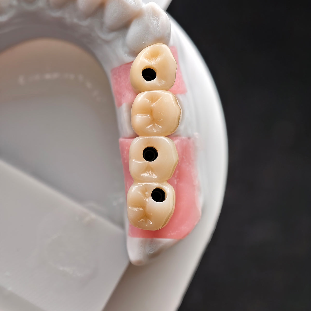 Custom Zirconia Implant Crown And Bridge