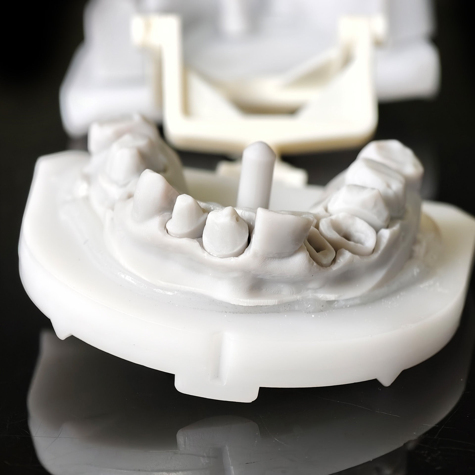 Co - Cr PFM Dental Bridge With Metal Post-And-Core