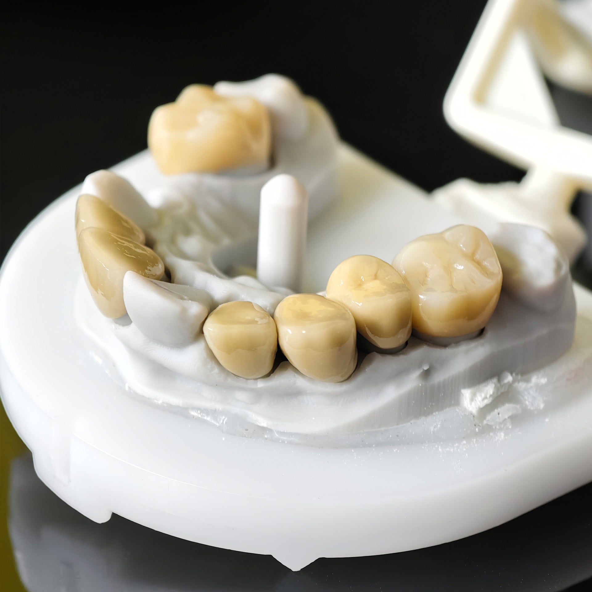 Co - Cr PFM Dental Bridge With Metal Post-And-Core