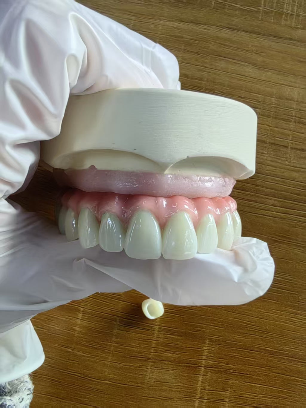 Malo Bridge Pure Titanium Metal Frame Full Arch Restoration Dental Lab In China