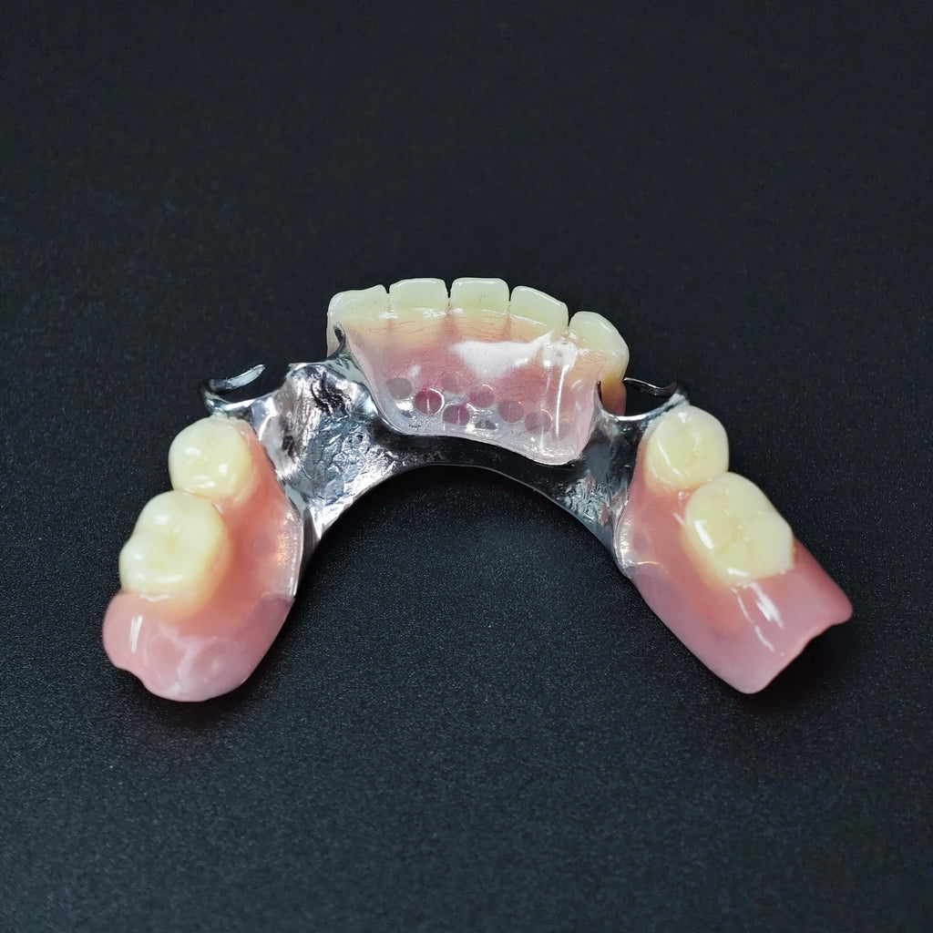 Cobalt Chrome Framework Denture Metal Framework With Acrylic Denture
