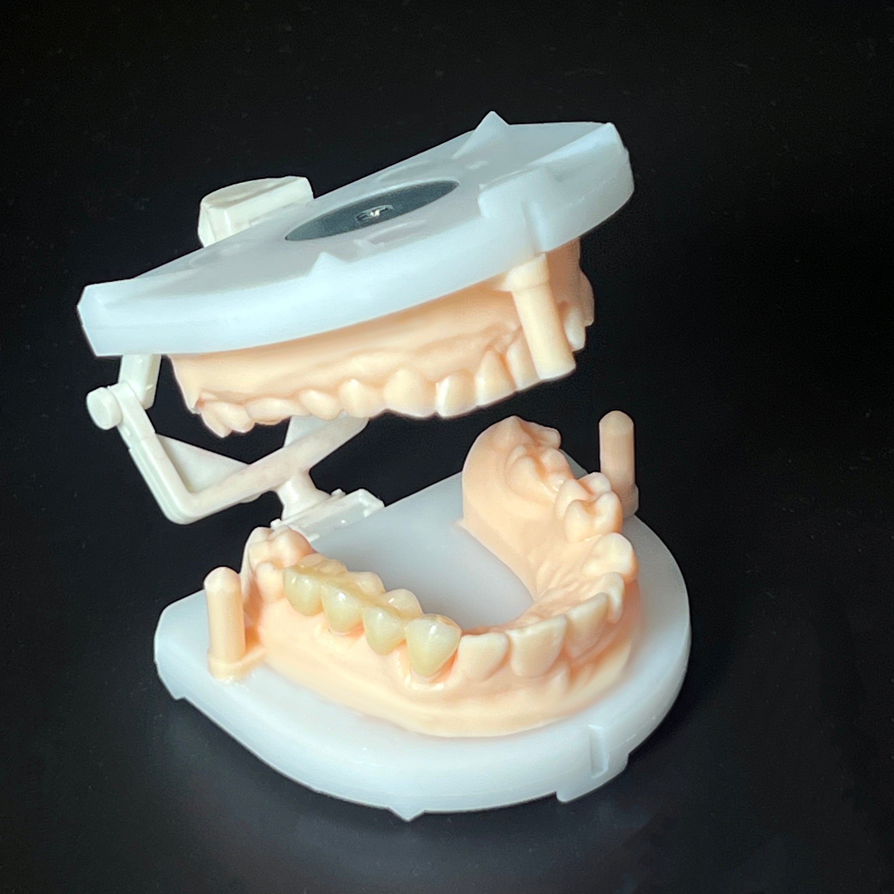 Multilayer Zirconia Crowns & Bridges